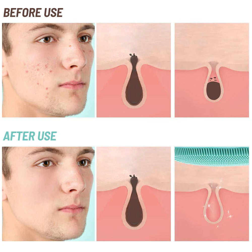 Silicone Face Scrubber Brush Skin Care Ultrasonic Cleaner Waterproof Face Cleansing Brush Remove Blackhead Beauty Massager