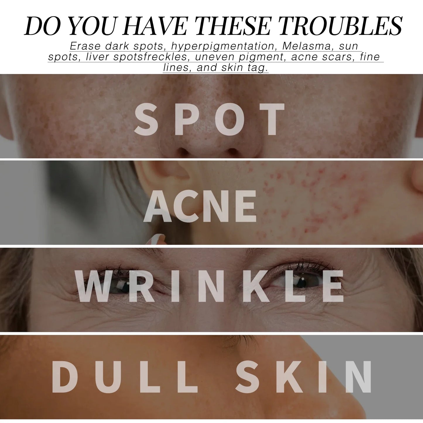 Retinol Collagen Cream Lighten Fine Lines Improve Darkness Reduce Dark Spots Tighten And Brighten Skin Moisturizing Face Cream